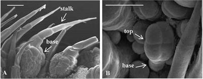Comparative Transcriptome Analysis of Hard and Tender Fruit Spines of Cucumber to Identify Genes Involved in the Morphological Development of Fruit Spines